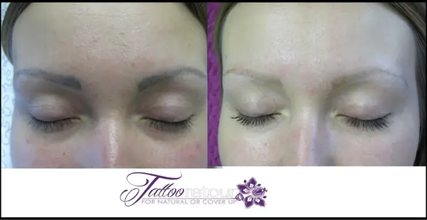 Vorher-nachher Vergleich der Entfernung von Permanent Make-up Augenbrauen Tattoo.